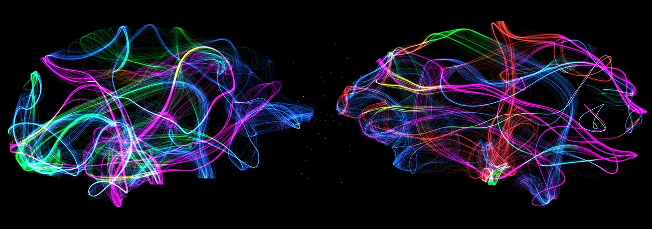 Œuvre CellandArt en duo, deux formes face à face, encadrée en format panoramique.